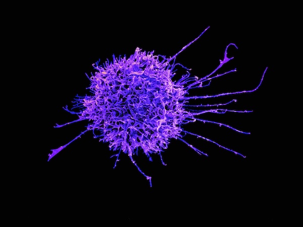 Immune cell